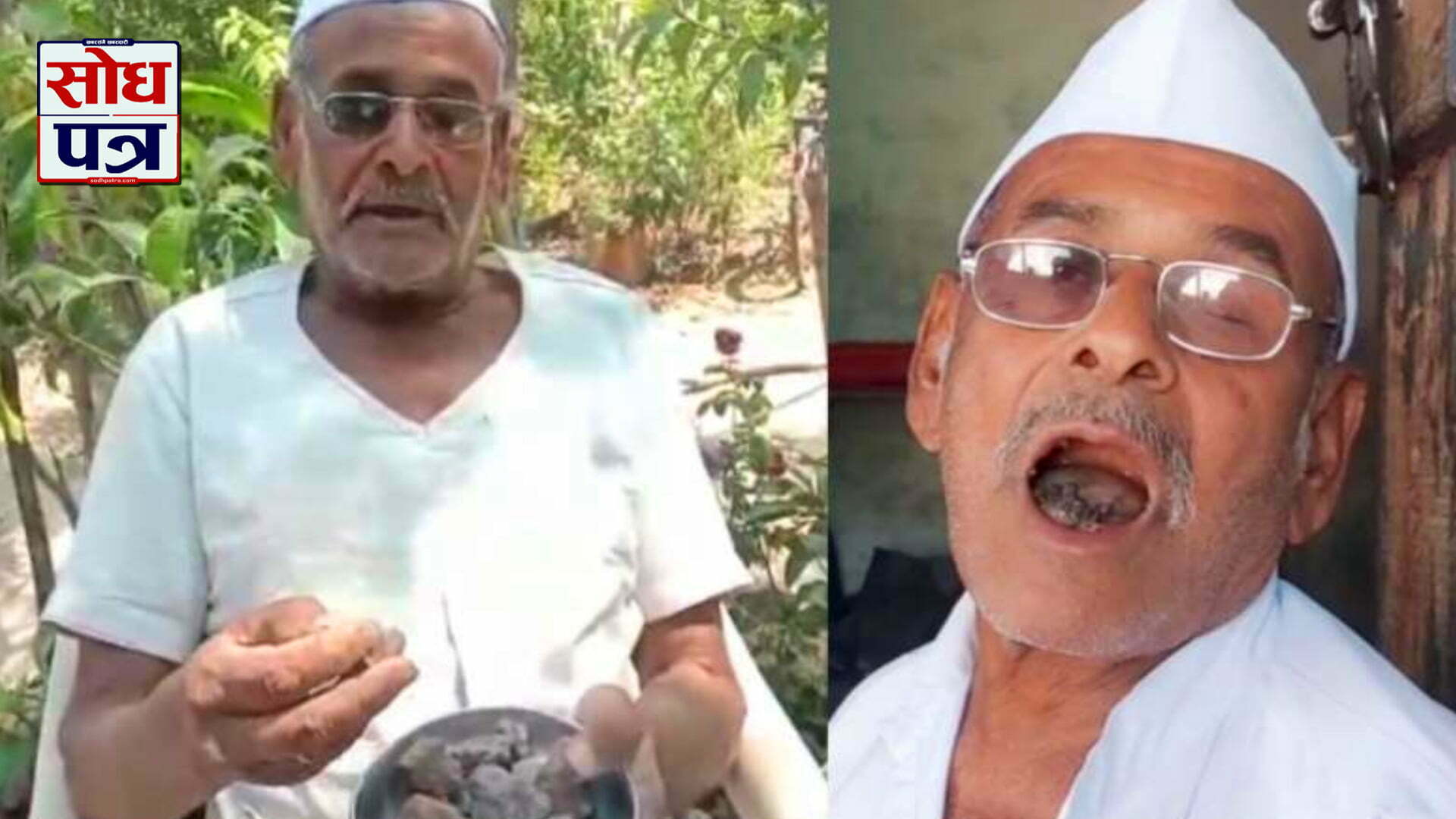 ८० वर्षका यी वृद्ध ३१ वर्ष यता खाइरहेका छन् ढुङ्गा