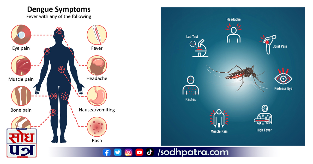 dengue Symptoms